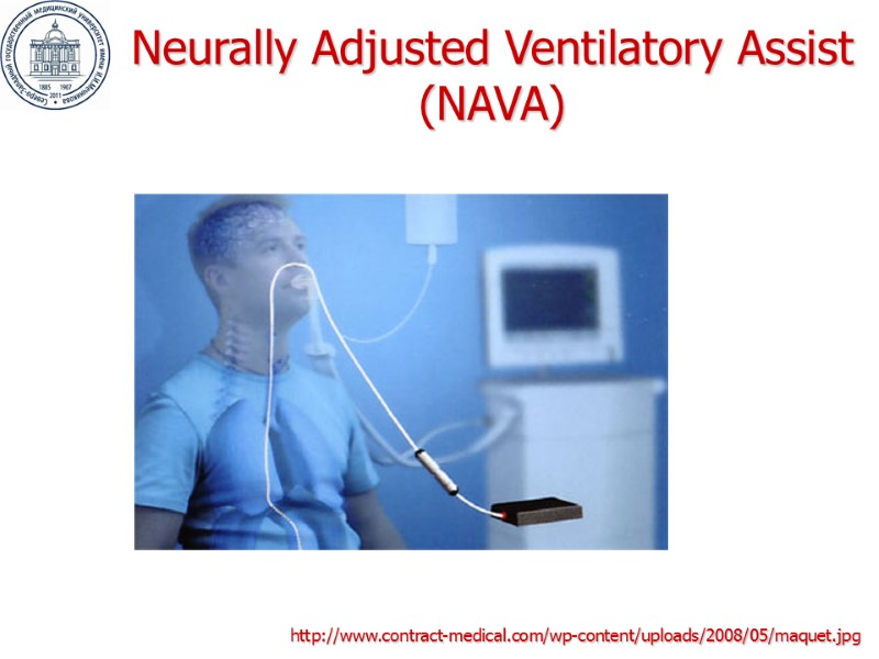 http://www.contract-medical.com/wp-content/uploads/2008/05/maquet.jpg Neurally Adjusted Ventilatory Assist (NAVA)